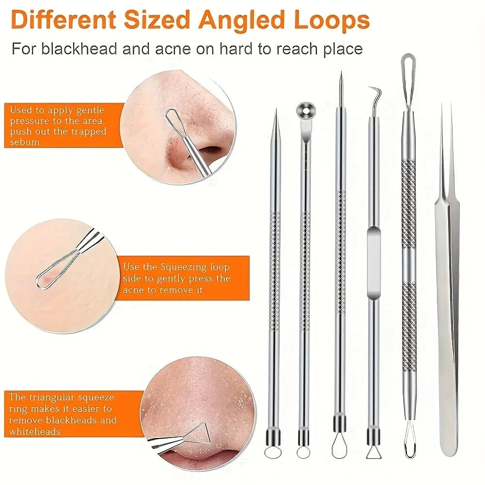 6Pcs Ultra-Precise Pimple Tweezers Set - Pro Acne and Blackhead Removal Tool -for Effective Face Care and Skin Purification